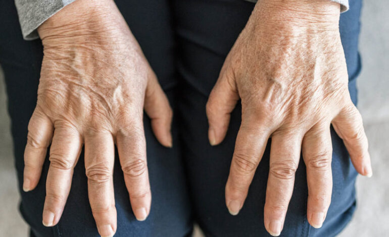 senior woman hands 820x547 1