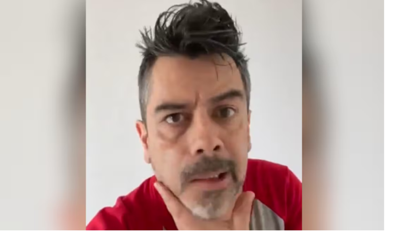 Carlos Espejel aparece con parálisis facial; atribuye su estado al estrés