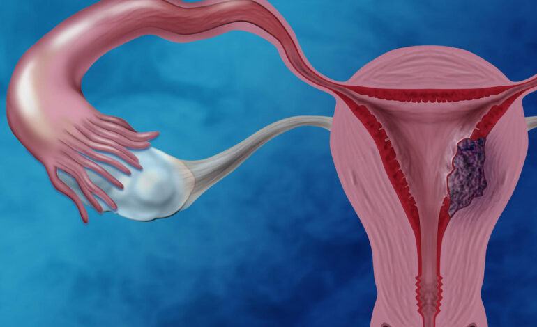 endometrial cancer nhgri