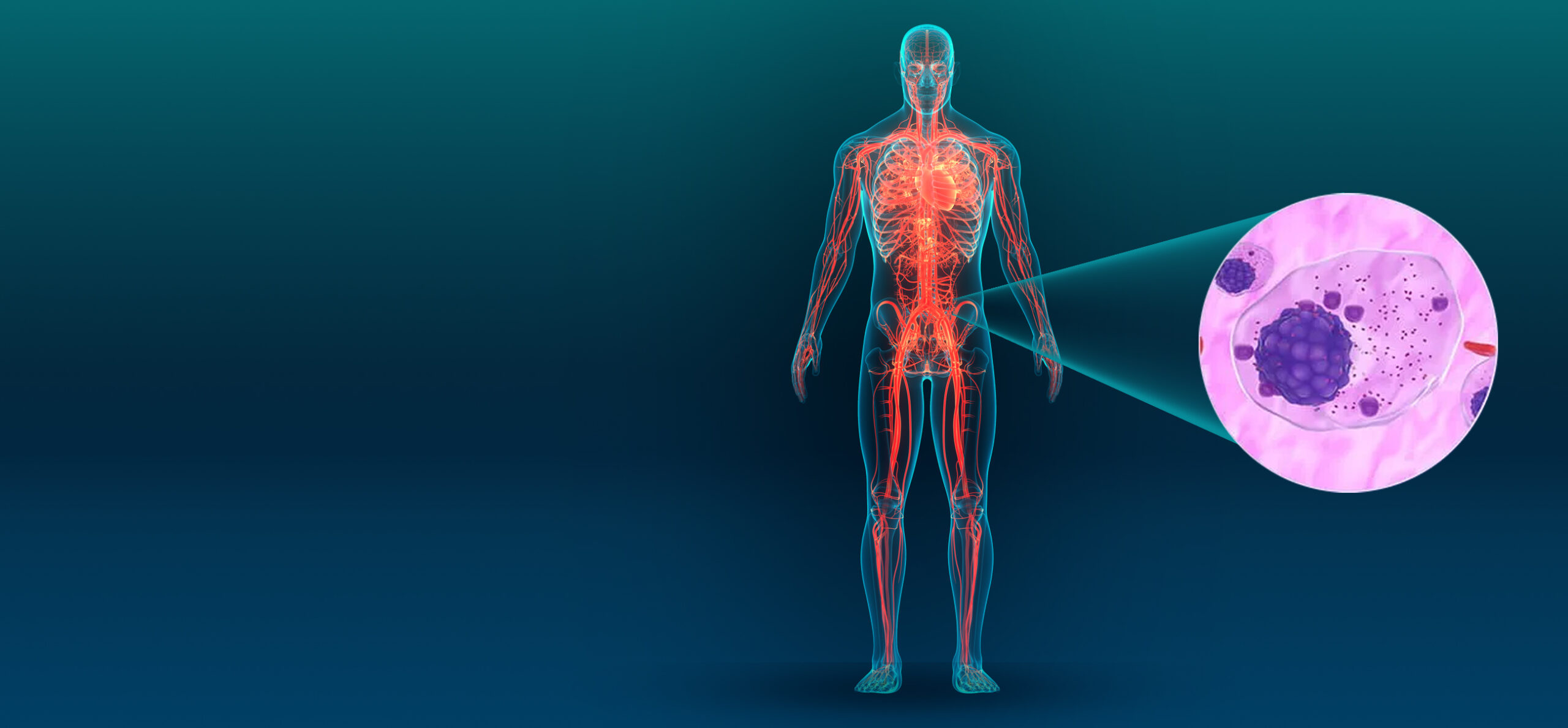 Un nuevo blanco terapéutico contra el mieloma múltiple: el rol del colesterol y el hierro