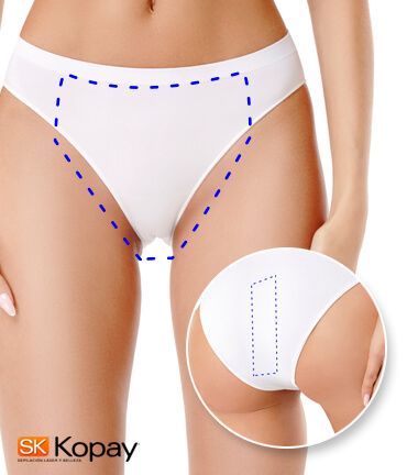 Depilacion Bikini Brasileno Kopay