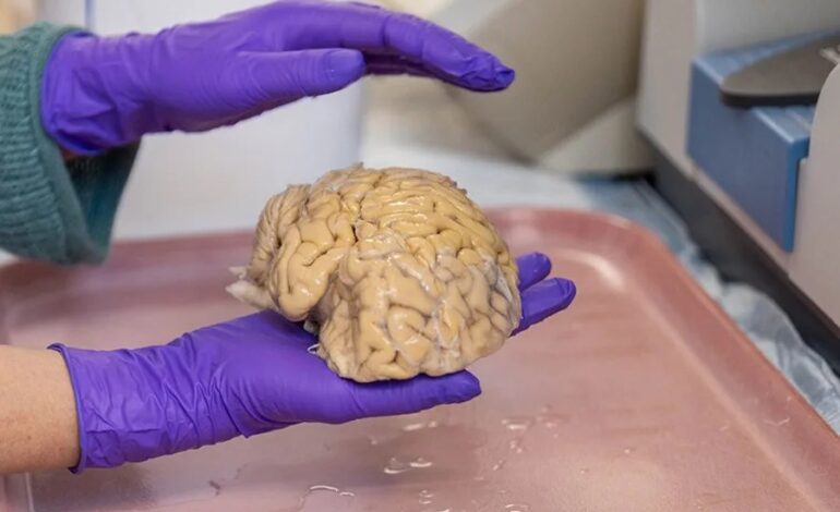 cerebro ‘superancianos