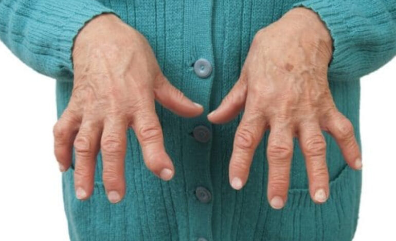 Seropositive Rheumatoid Arthritis 1 1100x619 1