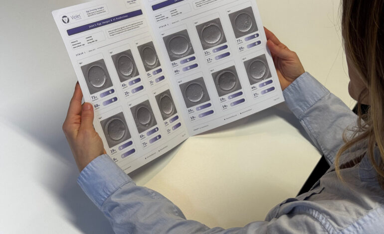 Patient reading Violet scaled