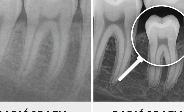 Preguntas frecuentes sobre rayos X panormicos digitales y convencionales 1