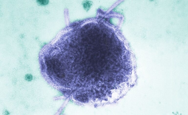 virus del sarampion 102145