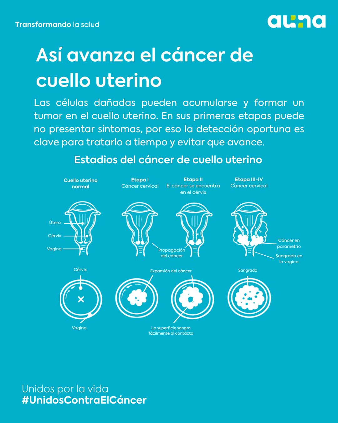 Día Mundial del Cáncer de Cuello Uterino: prevenir puede hacer la diferencia