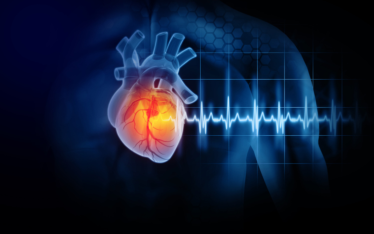iStock 1359314170